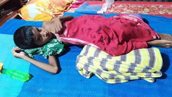 ভাঙ্গুড়ায় অর্থাভাবে বিনাচিকিৎসায় ভুগছে স্কুলছাত্রী নুপুর