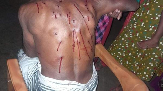 সুজানগরে ইউপি নির্বাচনকে কেন্দ্র করে সহিংসতা, আহত ১৫