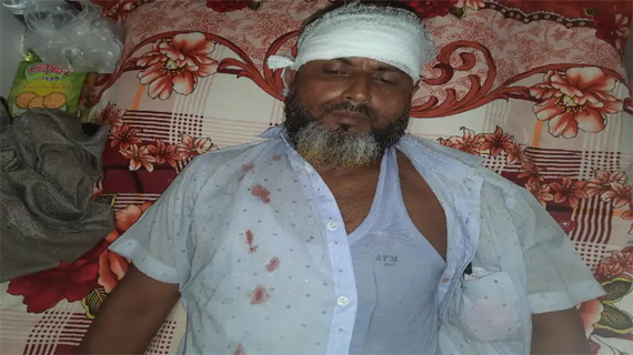 ভাঙ্গুড়ায় স্কুল শিক্ষককে পিটিয়ে জখম