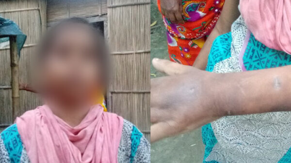 দেরি হলেই গরম খুন্তির ছ্যাকা, মুখে পুরে দেওয়া হতো গামছা