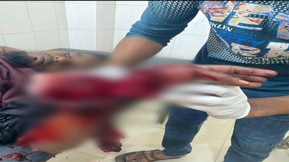 ভাঙ্গুড়ায় পূর্ব শত্রুতার জেরে পিতা-পুত্রকে কুপিয়ে হত্যার চেষ্টা