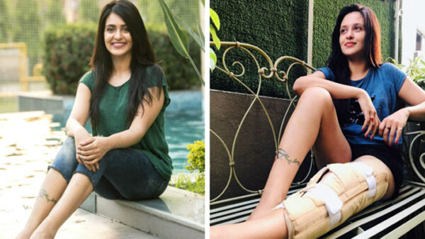 শুটিংয়ে আচমকা ঢুকে গেল মোটরসাইকেল, পা ভাঙলো নায়িকার