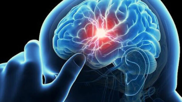 শীতকালে স্ট্রোকপরবর্তী করণীয়